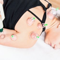 M021F (ALEJA1) Z006D   BAŃKI CHIŃSKIE BEZOGNIOWE PRÓŻNIOWE CELLULIT 12SZT -O022