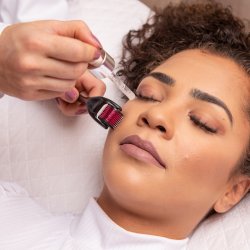 M000   WAŁEK ROLLER MASAŻER IGŁY DO TWARZY ZAROSTU BRODY -mały U015